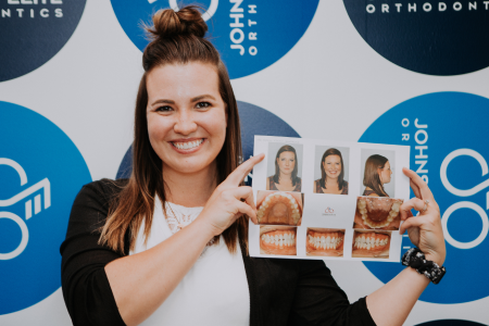 Girl Smiling with pictures of her smile transformation